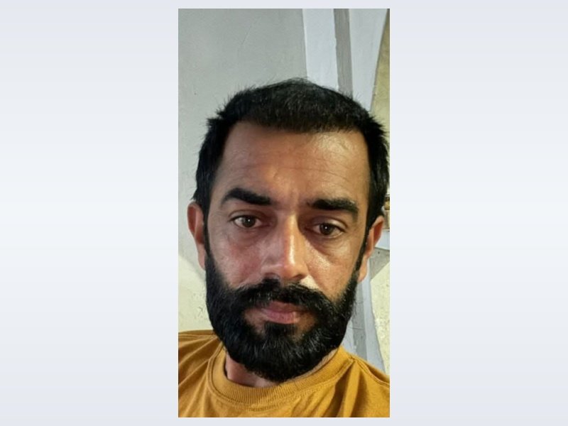 Patient Case 1: 12 Months mature regrowth result