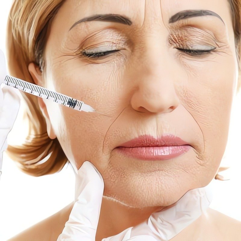 Anti-Aging and Skin Tightening Treatment