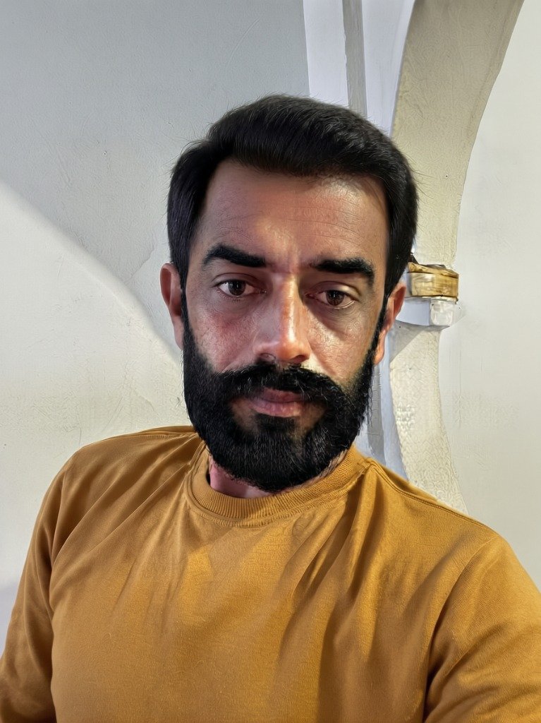 Bilal Ahmed - Hair Art Patient