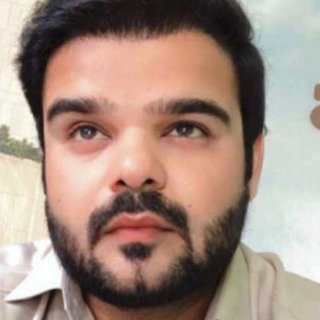 Zubair Hassan - Hair Art Patient