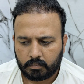 Farhan Siddiqui - Verified Hair Art Patient